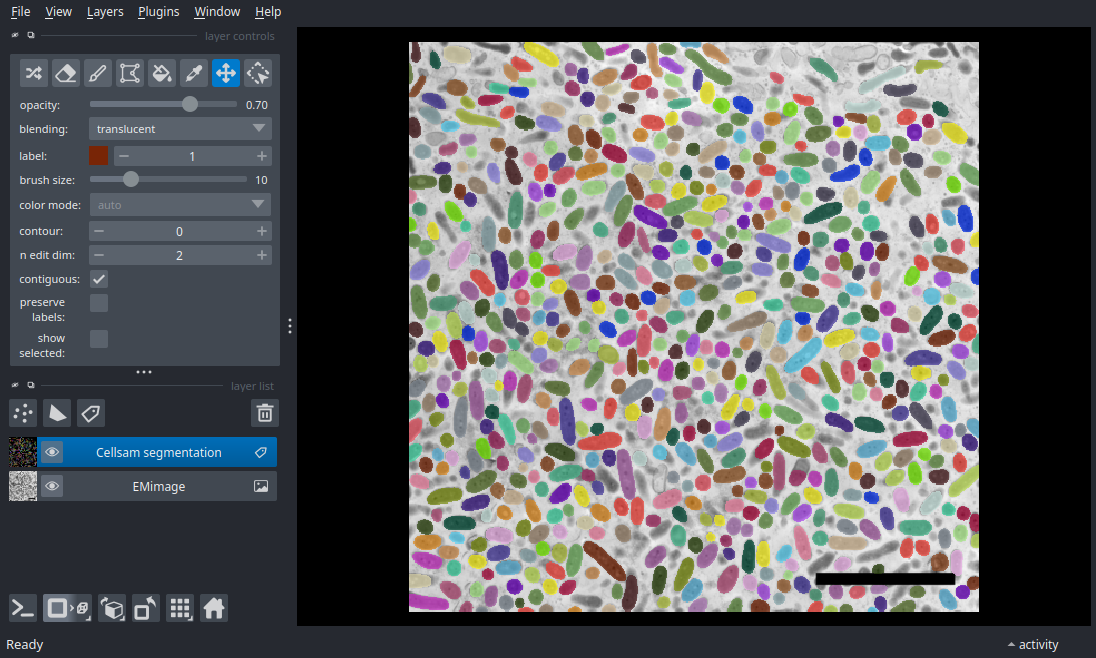 plot electron microscopy